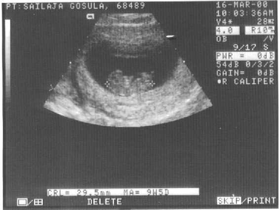 B10weeks.jpg