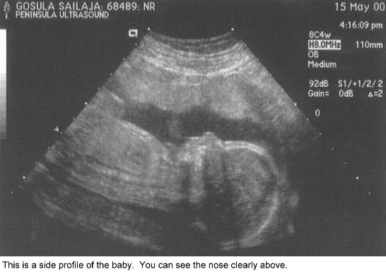 B18weeks2.jpg